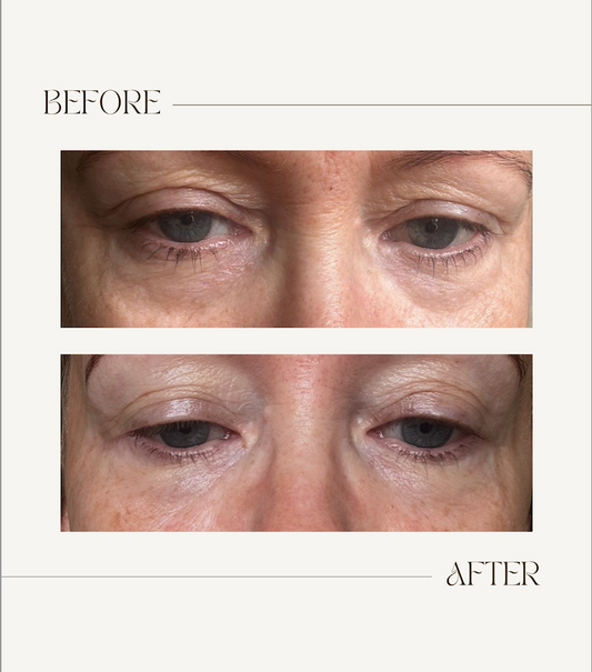 EYE TO EYE Bioactive Eye Serum 15ml